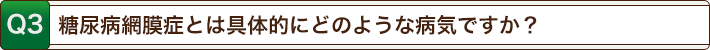 糖尿病網膜症とは具体的にどのような病気ですか？