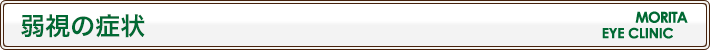 弱視の症状